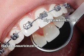 Diş Teli Maliyeti 2025